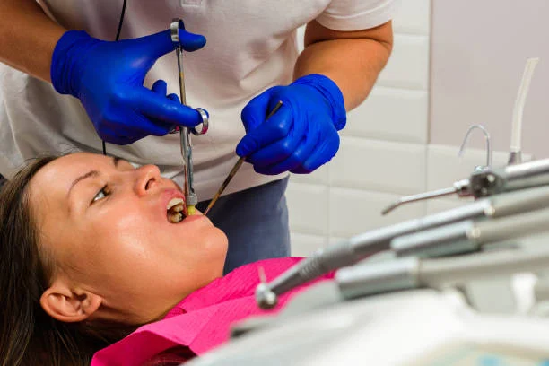 Minor Oral Surgery (MOS) at Keluarga Dental Smile, Sentul Kuala Lumpur